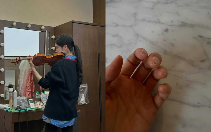 徐玄練習到手長繭。(圖/翻攝自IG)