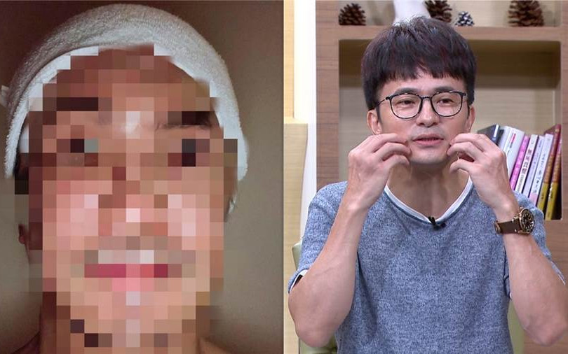 唐從聖臉毀腫脹40天 照顧失智雙親大喊「不想活了」