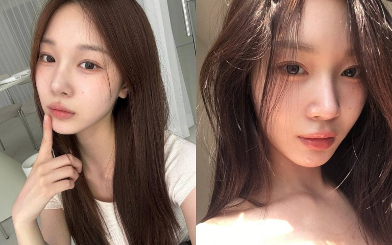 成年後還狂長痘？關鍵成因＋避免方法一次看懂