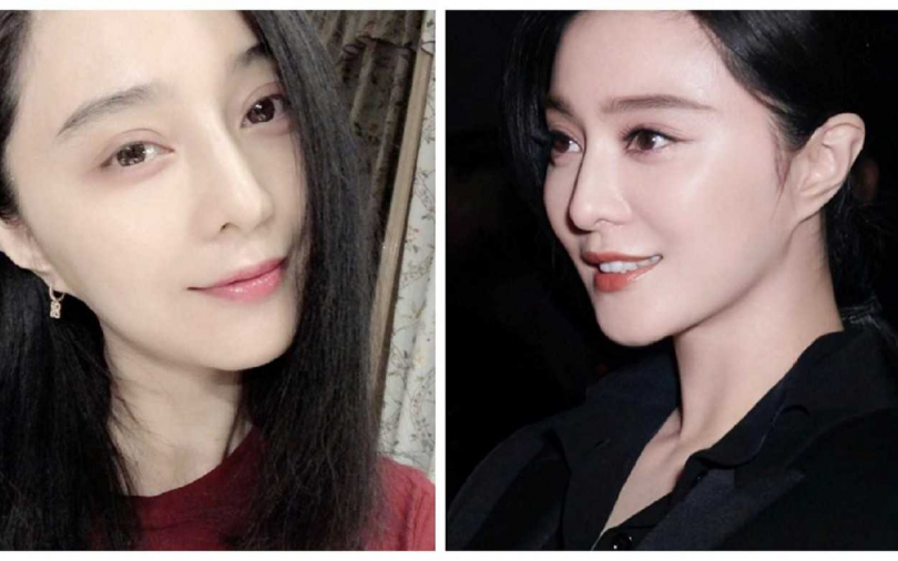 皮膚準備進廠維修,年底最強醫美排行榜TOP3揭曉,據說范冰冰也偷偷來台打這項