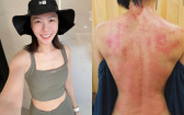 大牙曬「背部整片血紅照」嚇壞粉絲！超狂細腰曝光，網驚呆：視線移不開