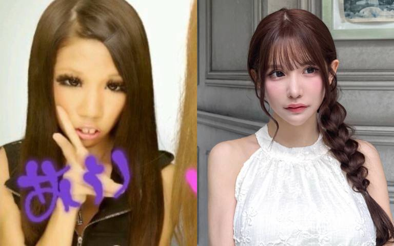 從媽媽嫌醜、校園霸凌的陰影到坦然公開整容史爆紅！日本女孩砸550萬換一張臉，平瀨愛里用血汗與意志打贏的人生逆襲戰