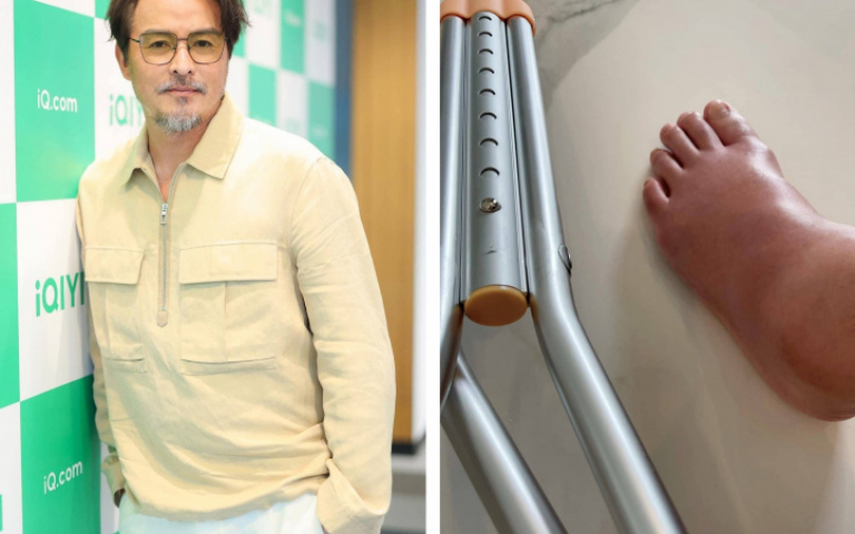 李銘順腳傷「不能步行」 宣布缺席金鐘:非常遺憾