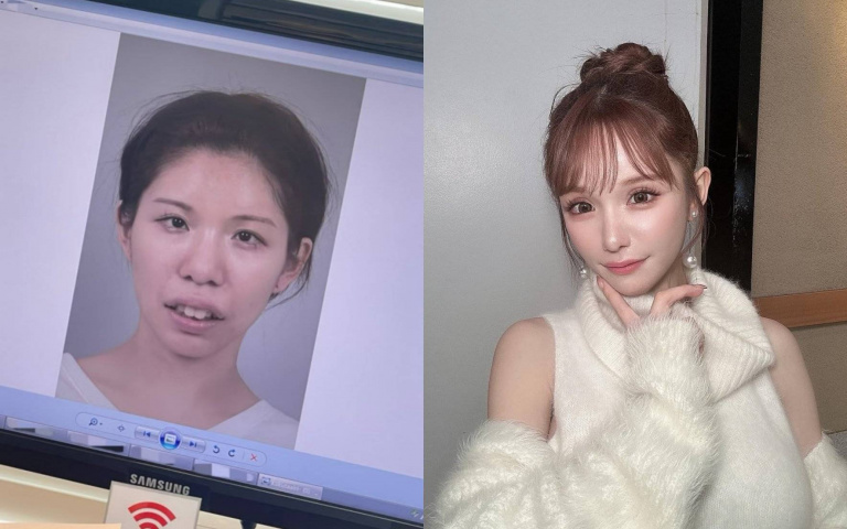 日本網紅花千萬整形不後悔！直呼「如果20歲有這張臉人生會更輕鬆」