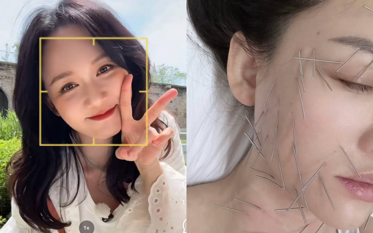 陳喬恩自嘲上鏡就胖3公斤！挑戰超狂減肥法連「全臉扎針」都試過！