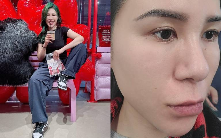 丹妮婊姐分享抗痘心酸史！提醒網友擠完痘痘必做「這動作」才能幫傷口神救援！