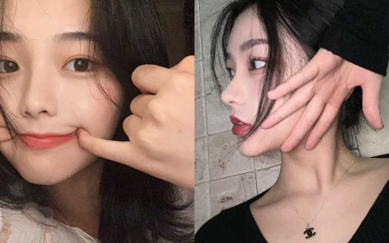 都幾歲了還長痘痘?皮膚科醫師廖苑利詳解這幾類痘人為什麼長痘!夏天去痘大法一起學!