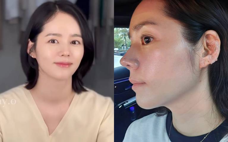 不吃麵食、速食、甜食!「韓國第一美女」韓佳人靠「食療」養出最高級的素顏美肌