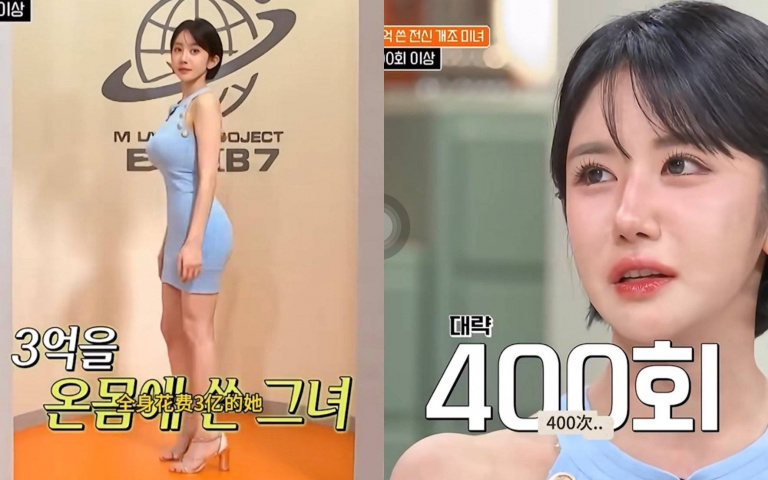 韓女砸3億整型400次「連肚臍、耳朵都動刀」！揭背後陰影：男友嫌醜讓她自卑3年
