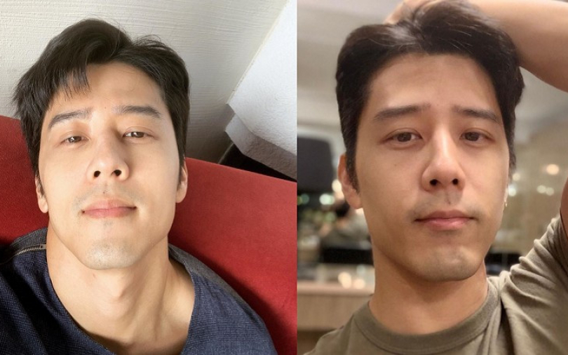 胡宇威為新戲壓力大！怕髮際線往後退　天天照顧頭皮