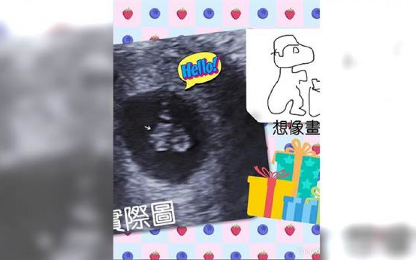 香蕉哥哥、草莓姊姊喜迎小香草　透露懷孕前期不穩定